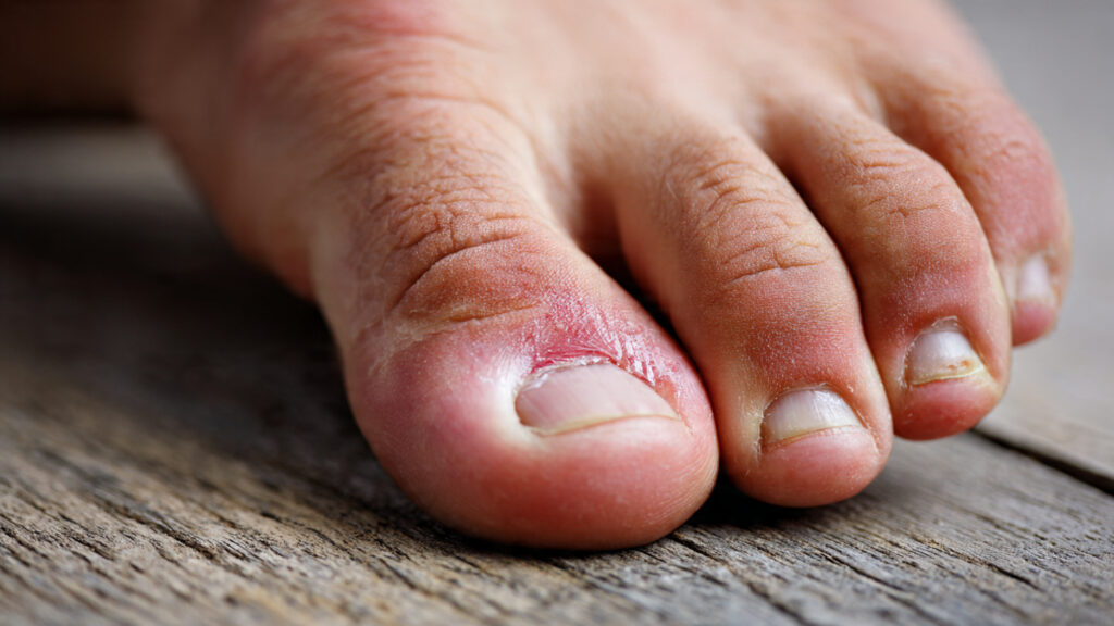 Why Should You Avoid Touching the Callus of a New Cutting